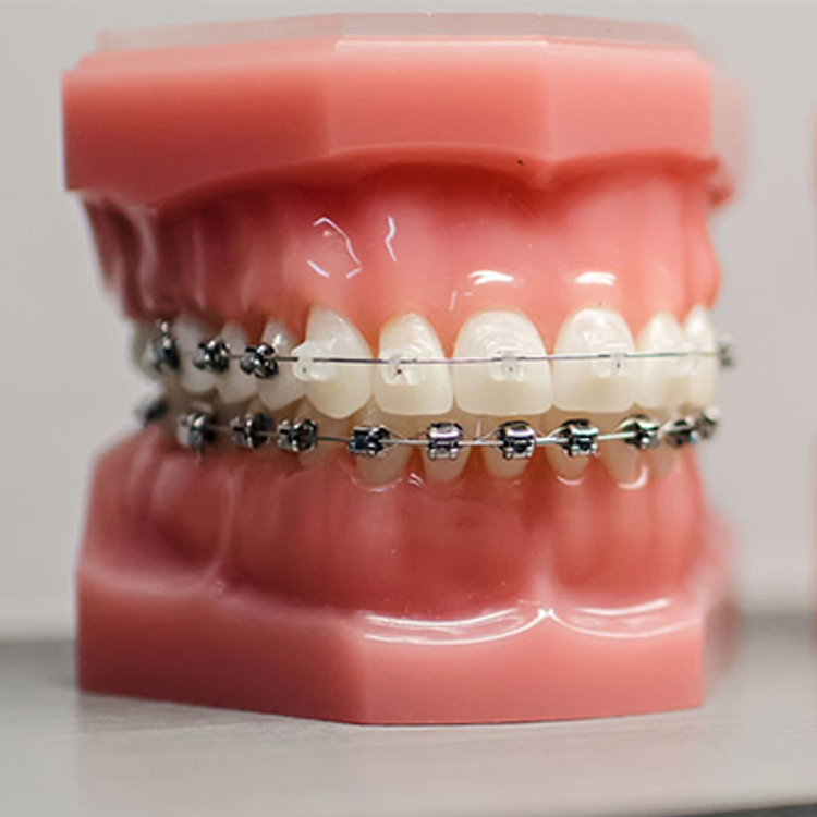 Orthodontics1